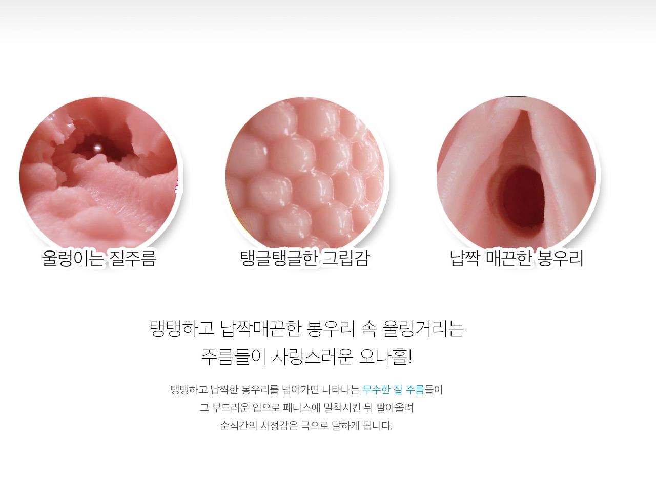 질 주름 로린코 설명