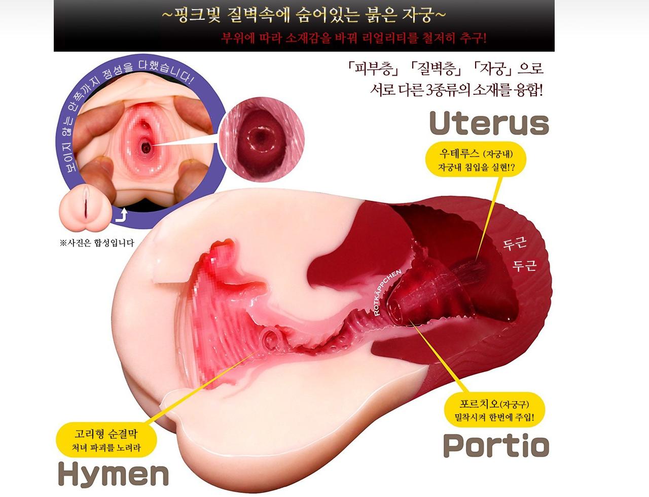 극채 우테루스 설명